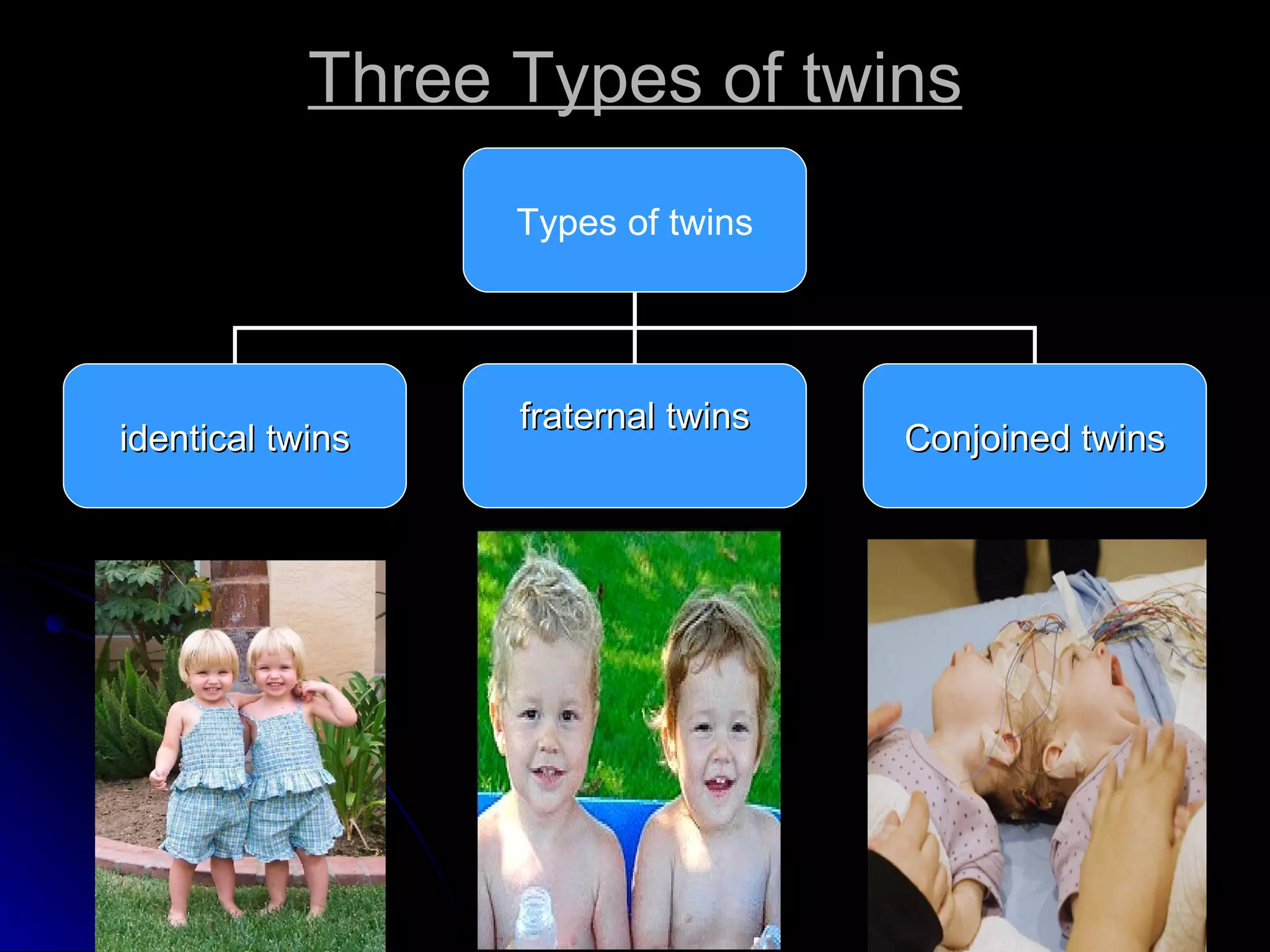 Three Types of twins Types of twins identical   twins fraternal twins Conjoined twins 