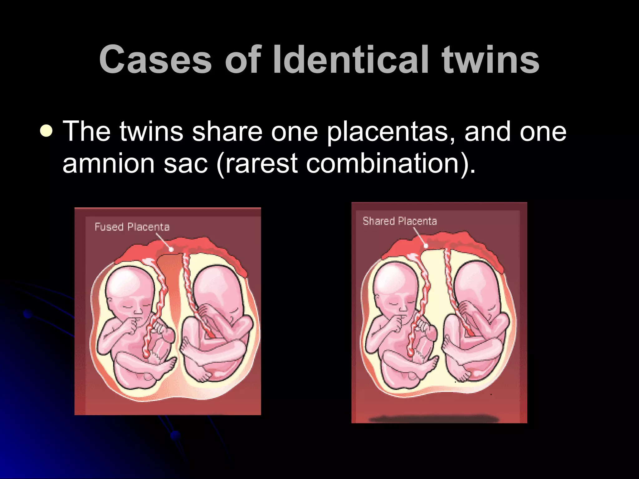 Cases of Identical twins The twins share one placentas, and one amnion sac (rarest combination).  