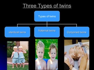 Three Types of twins Types of twins identical   twins fraternal twins Conjoined twins 