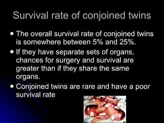 Survival rate of conjoined twins The overall survival rate of conjoined twins is somewhere between 5% and 25%.  If they have separate sets of organs, chances for surgery and survival are greater than if they share the same organs.  Conjoined twins are rare and have a poor survival rate 
