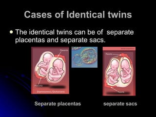 Cases of Identical twins The identical twins can be of  separate placentas and separate sacs.  Separate placentas  separate sacs 