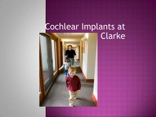 Cochlear Implants at Clarke  