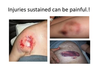 Injuries sustained can be painful.!
 