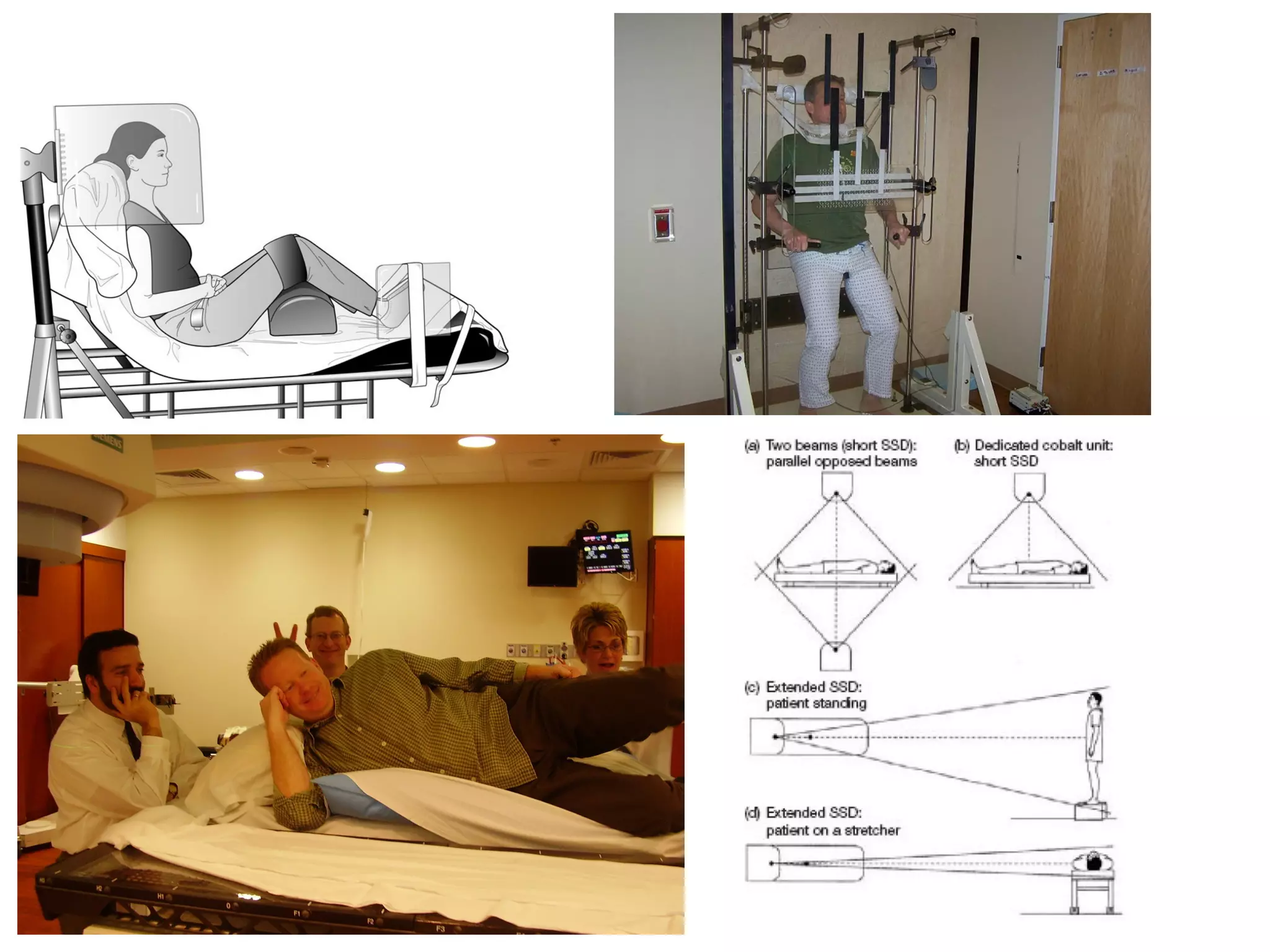 Special Procedures: TBI, TSET and IORT | PDF