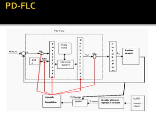 OPTIMIZATION OF THE FUZZY CONTROLLER FOR AN IMPLANTABLE INSULIN DELIVERY SYSTEM