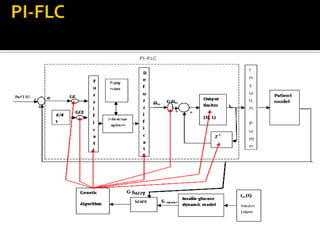OPTIMIZATION OF THE FUZZY CONTROLLER FOR AN IMPLANTABLE INSULIN DELIVERY SYSTEM