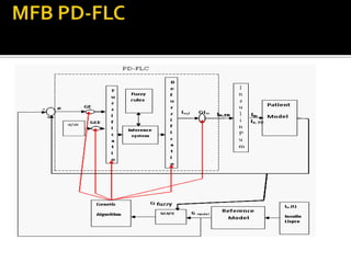 OPTIMIZATION OF THE FUZZY CONTROLLER FOR AN IMPLANTABLE INSULIN DELIVERY SYSTEM