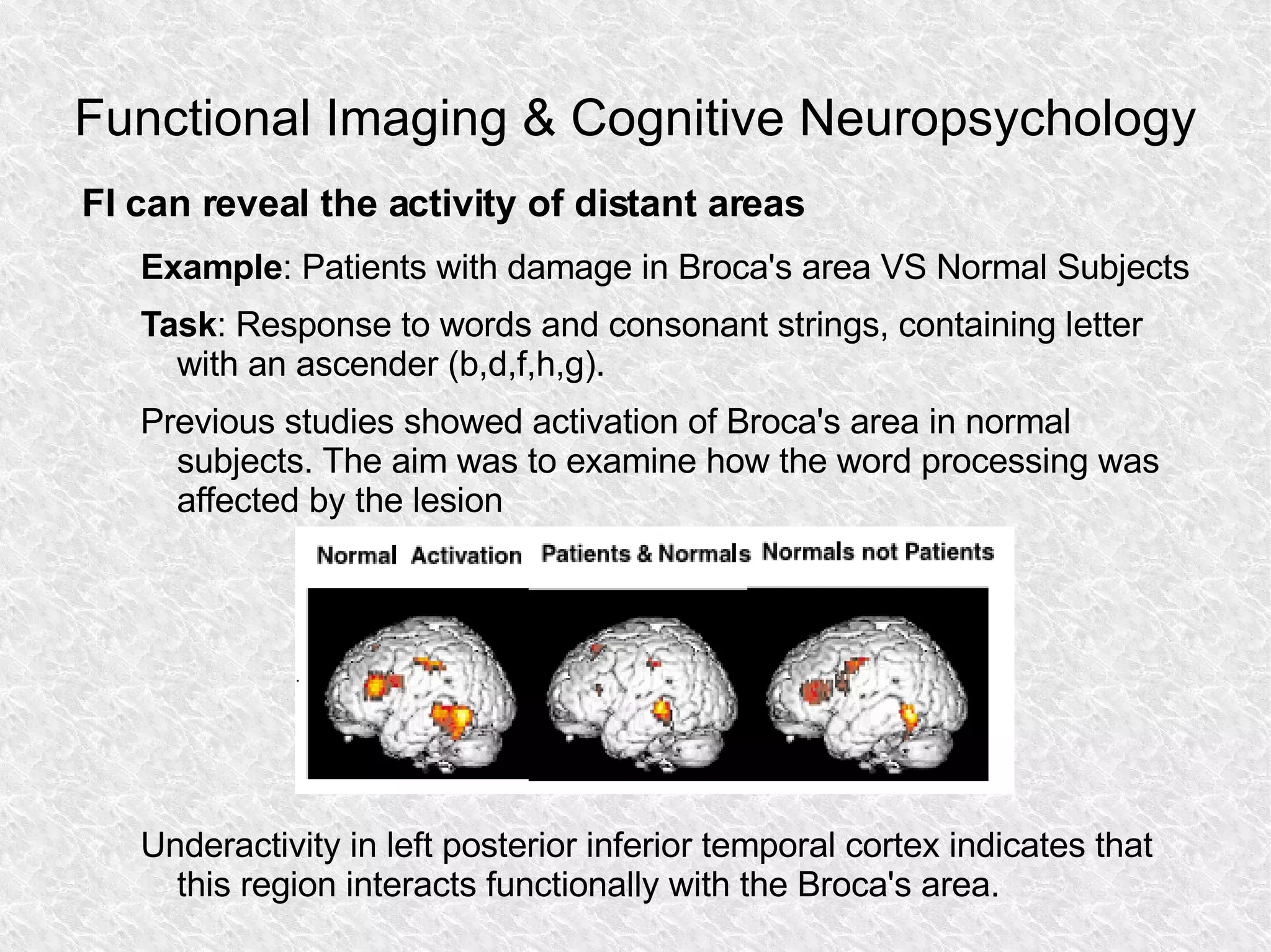 Functional Imaging & Cognitive Neuropsychology FI can reveal the activity of distant areas Example : Patients with damage in Broca's area VS Normal Subjects Task : Response to words and consonant strings, containing letter with an ascender (b,d,f,h,g).  Previous studies showed activation of Broca's area in normal subjects. The aim was to examine how the word processing was affected by the lesion Underactivity in left posterior inferior temporal cortex indicates that this region interacts functionally with the Broca's area. 