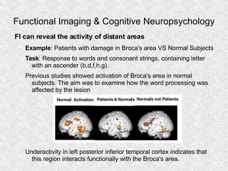 Functional Imaging & Cognitive Neuropsychology <ul><li>FI can reveal the activity of distant areas </li></ul><ul><ul><li>E...
