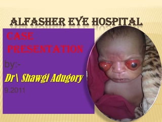 ALFASHER EYE HOSPITAL
Case
presentation
by:-
Dr Shawgi Adugory
9.2011
 