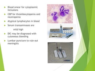 

Blood smear for cytoplasmic
inclusions



CBP for thrombocytopenia and
neutropenia



Atypical lymphocytes in blood



Serum transaminases are
mild high



DIC may be diagnosed with
cutaneous bleeding



Lumbar puncture to rule out
meningitis

 