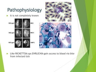 Pathophysiology


It is not completely known



Like RICKETTSIA sps EHRLICHIA gain access to blood via bite
from infected tick

 