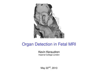 Organ Detection in Fetal MRI
Kevin Keraudren
Imperial College London

May 22nd , 2013

 