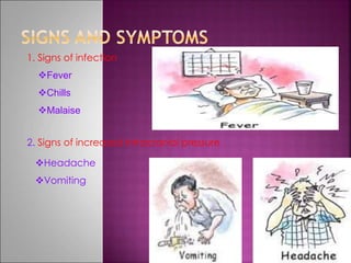1. Signs of infection
Fever
Chills
Malaise
2. Signs of increased intracranial pressure
Headache
Vomiting
 