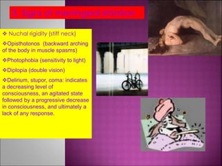 3. Signs of meningeal irritation
 Nuchal rigidity (stiff neck)
Opisthotonos (backward arching
of the body in muscle spasms)
Photophobia (sensitivity to light)
Diplopia (double vision)
Delirium, stupor, coma: indicates
a decreasing level of
consciousness, an agitated state
followed by a progressive decrease
in consciousness, and ultimately a
lack of any response.
 