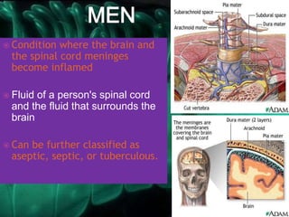  Condition where the brain and
the spinal cord meninges
become inflamed
 Fluid of a person's spinal cord
and the fluid that surrounds the
brain
 Can be further classified as
aseptic, septic, or tuberculous.
 