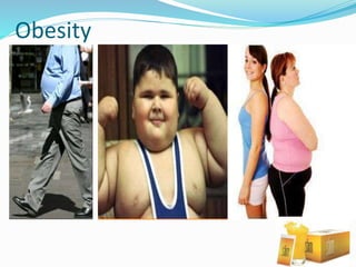 Obesity
 