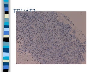 EE1/AE3
 