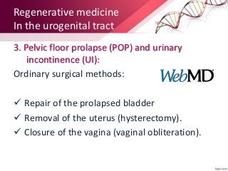 3. Uterine reconstruction (endometrial):
• Treatment of women with uterine factor
infertility.
• Engraftment of stem cells...