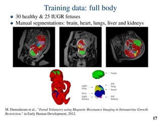 Training data: full body
30 healthy & 25 IUGR fetuses
Manual segmentations: brain, heart, lungs, liver and kidneys
M. Damodaram et al., “Foetal Volumetry using Magnetic Resonance Imaging in Intrauterine Growth
Restriction,” in Early Human Development, 2012.
17
 