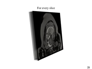 For every slice
21
 