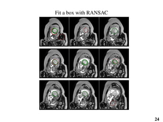 Fit a box with RANSAC
24
 