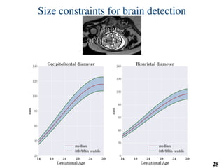 Size constraints for brain detection
OFDOFD
BPDBPD
14 19 24 29 34 39
Gestational Age
20
40
60
80
100
120
140
mm
Occipitofrontal diameter
median
5th/95th centile
14 19 24 29 34 39
Gestational Age
0
20
40
60
80
100
120
140
mm
Biparietal diameter
median
5th/95th centile
25
 