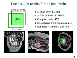 Localisation results for the fetal brain
>70%
Ground truth
Detection
Median error: 5.7 mm
>70% of the brain: 100%
Complete brain: 85%
Size inferred from gestational age
Runtime: <1min (desktop PC)
26
 