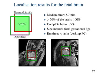 Localisation results for the fetal brain
>70%
Ground truth
Detection
Median error: 5.7 mm
>70% of the brain: 100%
Complete brain: 85%
Size inferred from gestational age
Runtime: <1min (desktop PC)
27
 