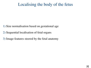 Localising the body of the fetus
1) Size normalisation based on gestational age
2) Sequential localisation of fetal organs
3) Image features steered by the fetal anatomy
32
 