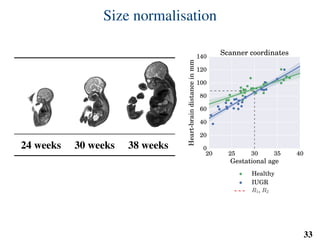 Size normalisation
24 weeks 30 weeks 38 weeks
20 25 30 35 40
Gestational age
0
20
40
60
80
100
120
140
Heart-braindistanceinmm
Scanner coordinates
Healthy
IUGR
R1, R2
A single model can be trained across all gestational ages.
33
 