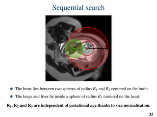 Sequential search
R1R1
R2R2
R
3
R
3
The heart lies between two spheres of radius R1 and R2 centered on the brain.
The lungs and liver lie inside a sphere of radius R3 centered on the heart.
R1, R2 and R3 are independent of gestational age thanks to size normalisation.
35
 