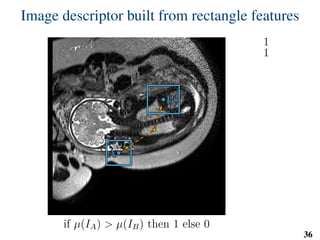 Image descriptor built from rectangle features
BB
AA
if µ(IA) > µ(IB) then 1 else 0
1
1
36
 