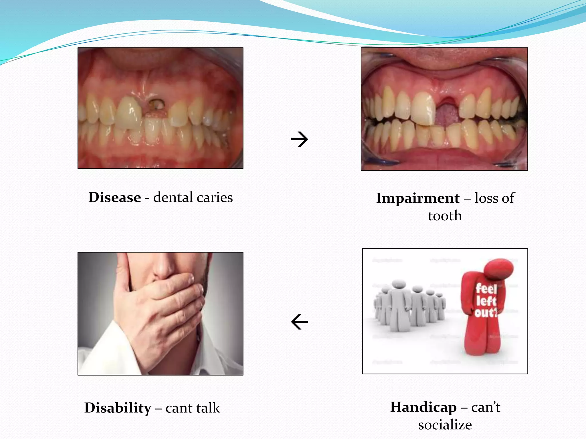 

Disease - dental caries Impairment – loss of
tooth
Disability – cant talk Handicap – can’t
socialize
 
