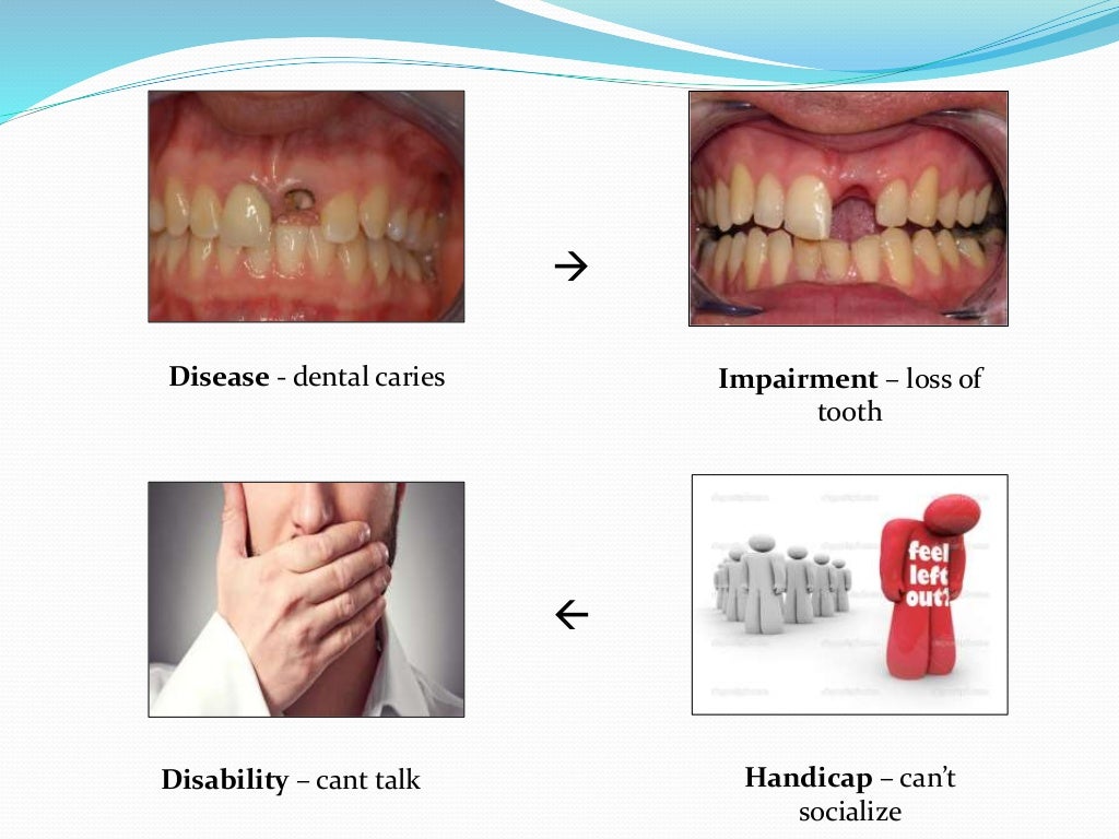 concepts of prevention in dentistry