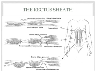 THE RECTUS SHEATH
 