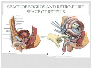SPACE OF BOGROS AND RETRO-PUBIC
SPACE OF RETZIUS
 