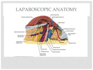 LAPAROSCOPIC ANATOMY
 