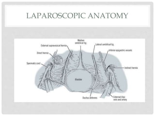 LAPAROSCOPIC ANATOMY
 
