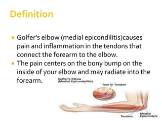  Golfer’s elbow (medial epicondilitis)causes
pain and inflammation in the tendons that
connect the forearm to the elbow.
 The pain centers on the bony bump on the
inside of your elbow and may radiate into the
forearm.
 