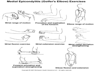 lateral & medial epicondylitis | PPT