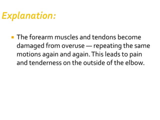  The forearm muscles and tendons become
damaged from overuse — repeating the same
motions again and again.This leads to pain
and tenderness on the outside of the elbow.
 