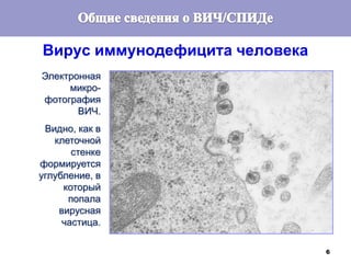 6
Электронная
микро-
фотография
ВИЧ.
Видно, как в
клеточной
стенке
формируется
углубление, в
который
попала
вирусная
частица.
Вирус иммунодефицита человека
 