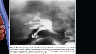 urinary tract radiology