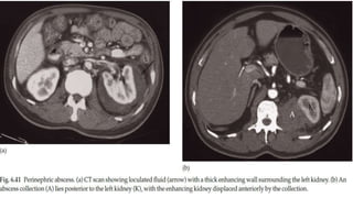 urinary tract radiology