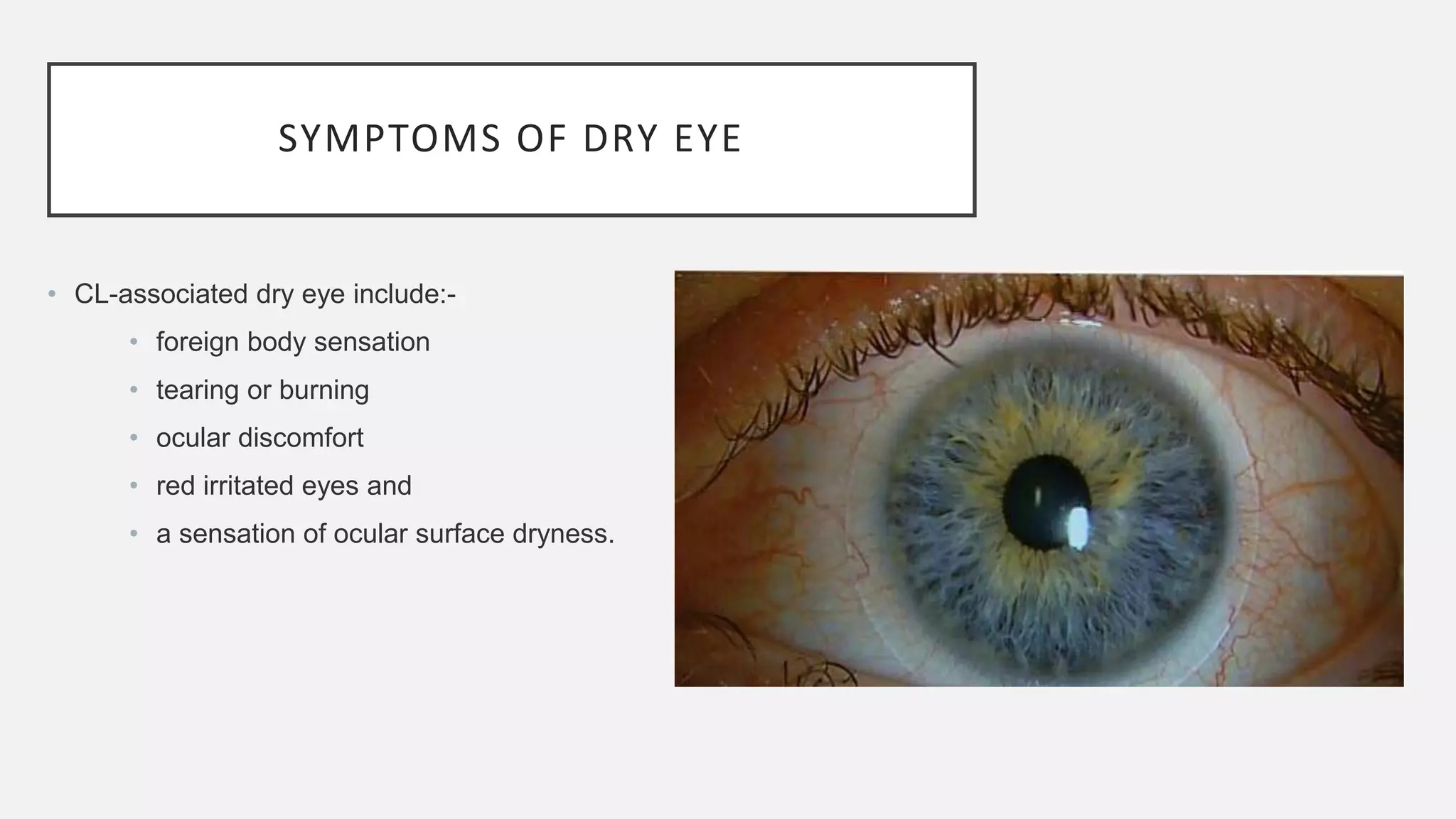 SYMPTOMS OF DRY EYE
• CL-associated dry eye include:-
• foreign body sensation
• tearing or burning
• ocular discomfort
• red irritated eyes and
• a sensation of ocular surface dryness.
 