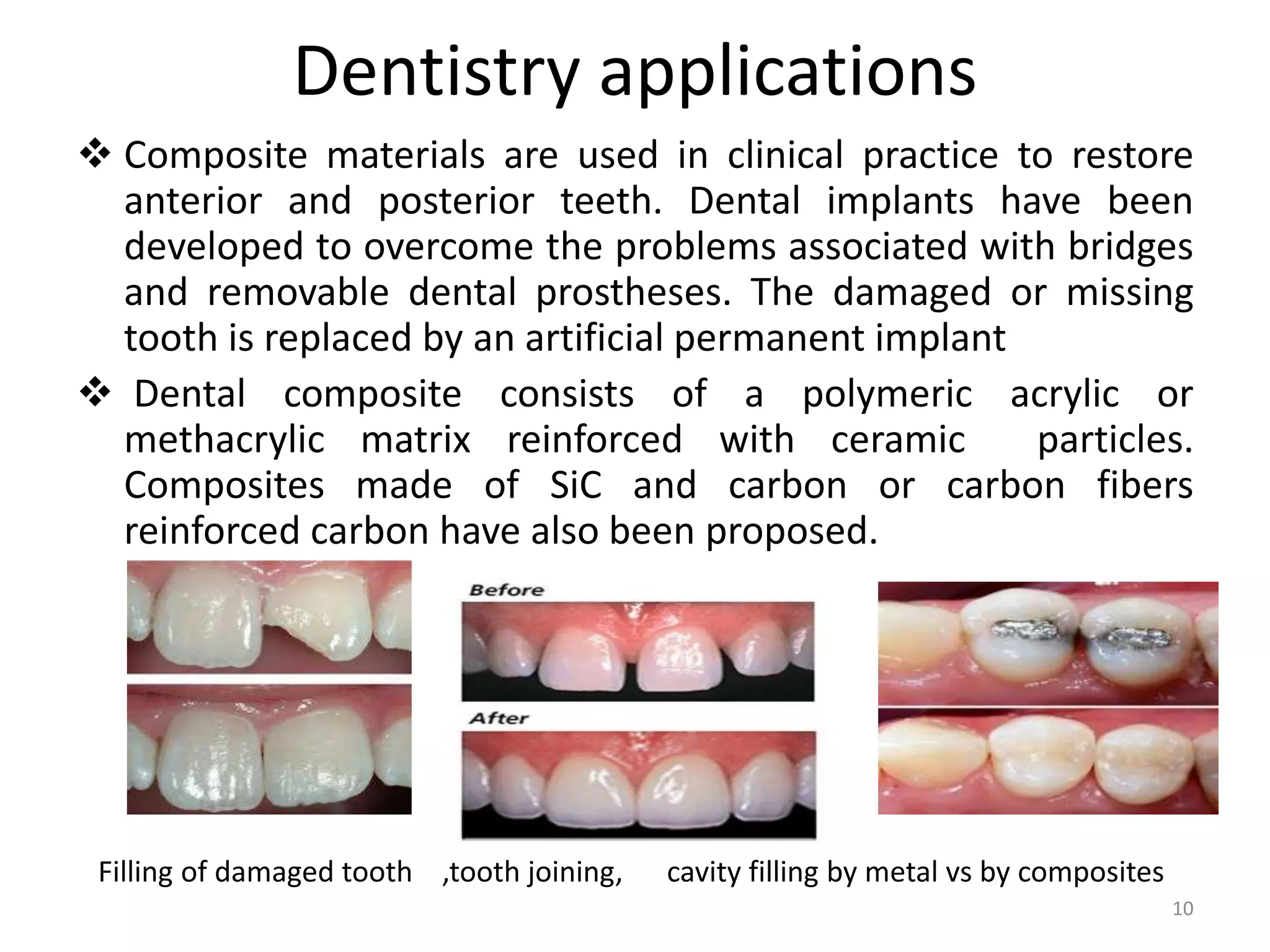 Dentistry applications
 Composite materials are used in clinical practice to restore
anterior and posterior teeth. Dental implants have been
developed to overcome the problems associated with bridges
and removable dental prostheses. The damaged or missing
tooth is replaced by an artificial permanent implant
 Dental composite consists of a polymeric acrylic or
methacrylic matrix reinforced with ceramic particles.
Composites made of SiC and carbon or carbon fibers
reinforced carbon have also been proposed.
Filling of damaged tooth ,tooth joining, cavity filling by metal vs by composites
10
 