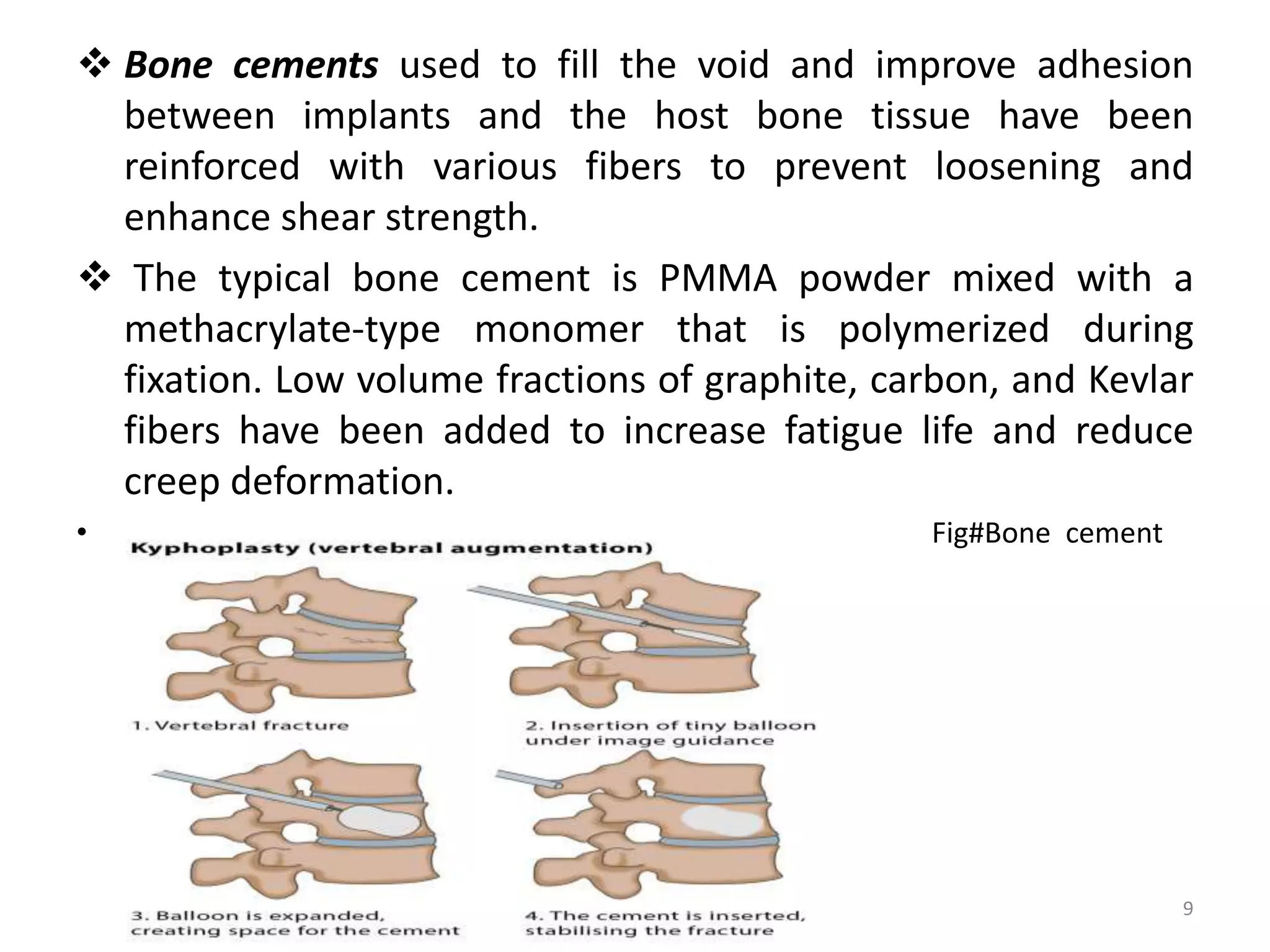  Bone cements used to fill the void and improve adhesion
between implants and the host bone tissue have been
reinforced with various fibers to prevent loosening and
enhance shear strength.
 The typical bone cement is PMMA powder mixed with a
methacrylate-type monomer that is polymerized during
fixation. Low volume fractions of graphite, carbon, and Kevlar
fibers have been added to increase fatigue life and reduce
creep deformation.
• Fig#Bone cement
9
 
