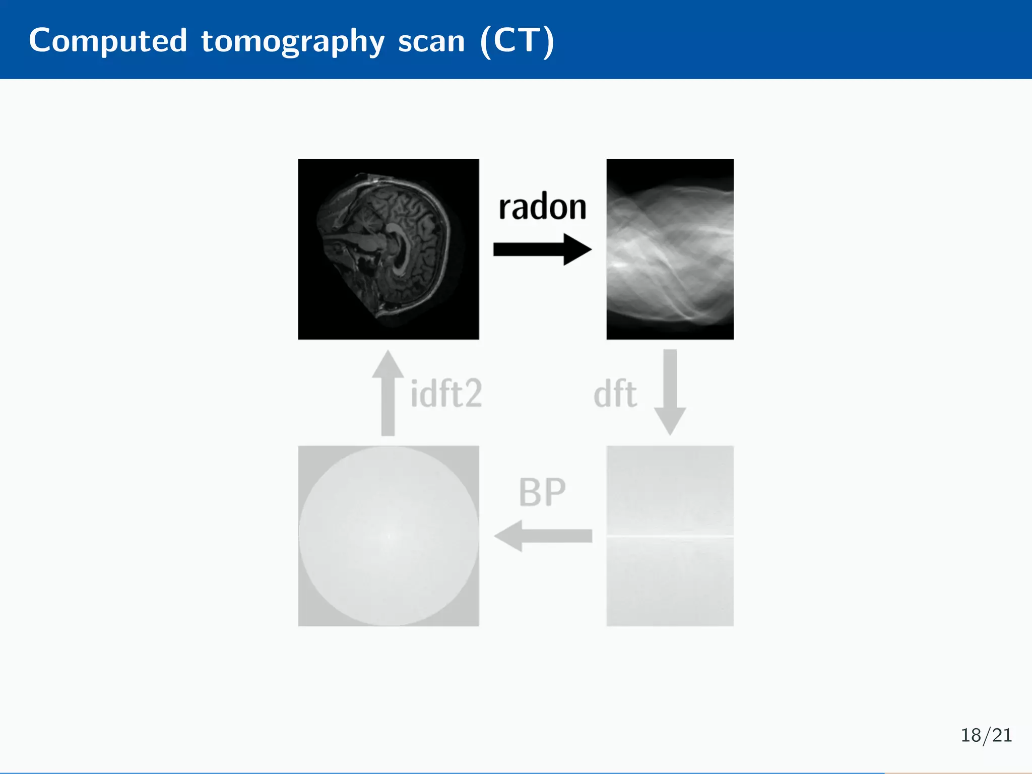 Computed tomography scan (CT) 18/21 