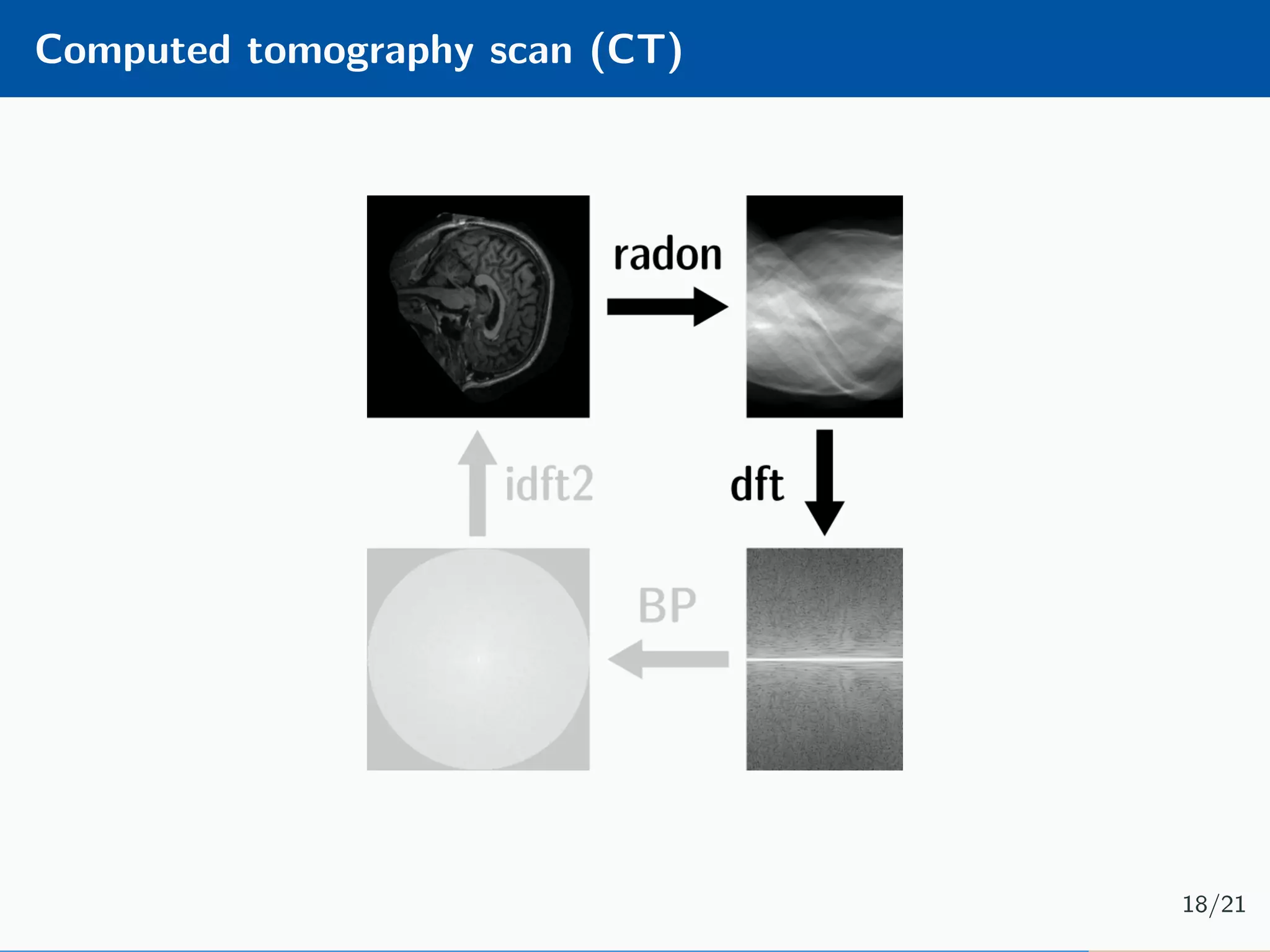 Computed tomography scan (CT) 18/21 